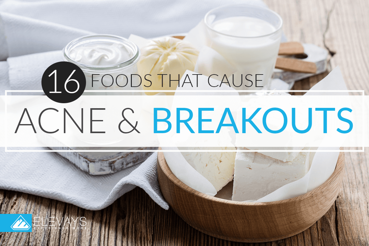 16 Foods that cause Acne & Breakouts