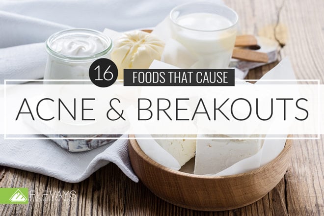 16-foods-that-cause-acne-and-breakouts-elevays