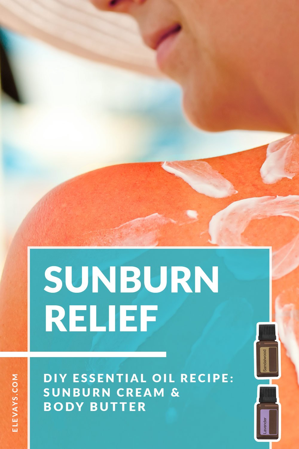 Get Sunburn Relief Fast with this Homemade Sunburn Cream Remedy Infused with Essential Oils