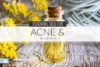 Top Essential Oils for Acne & Breakouts