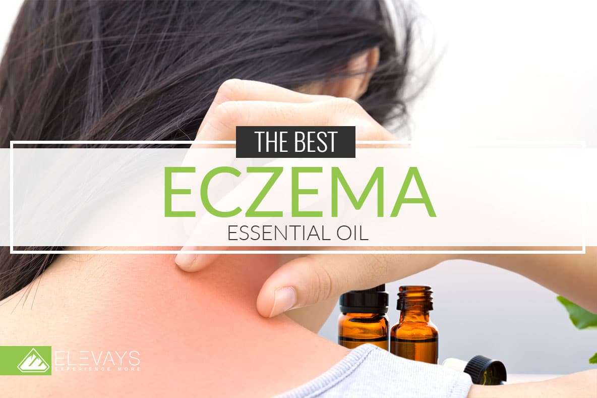 The Best Essential Oil for Eczema and Dry Skin