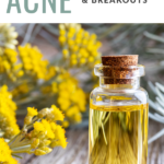 The Best Essential Oils for Acne, Breakouts and Skin Care