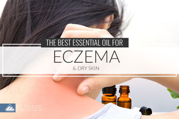 The Best Essential Oil for Eczema and Dry Skin - Elevays