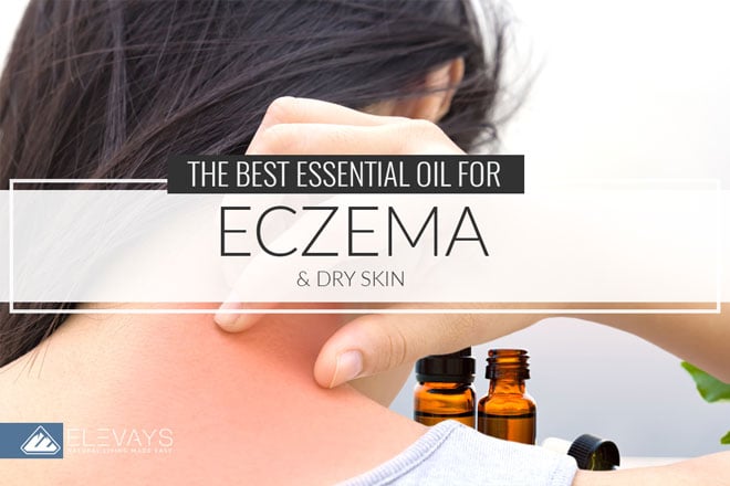 The Best Essential Oils for Eczema and Dry Skin