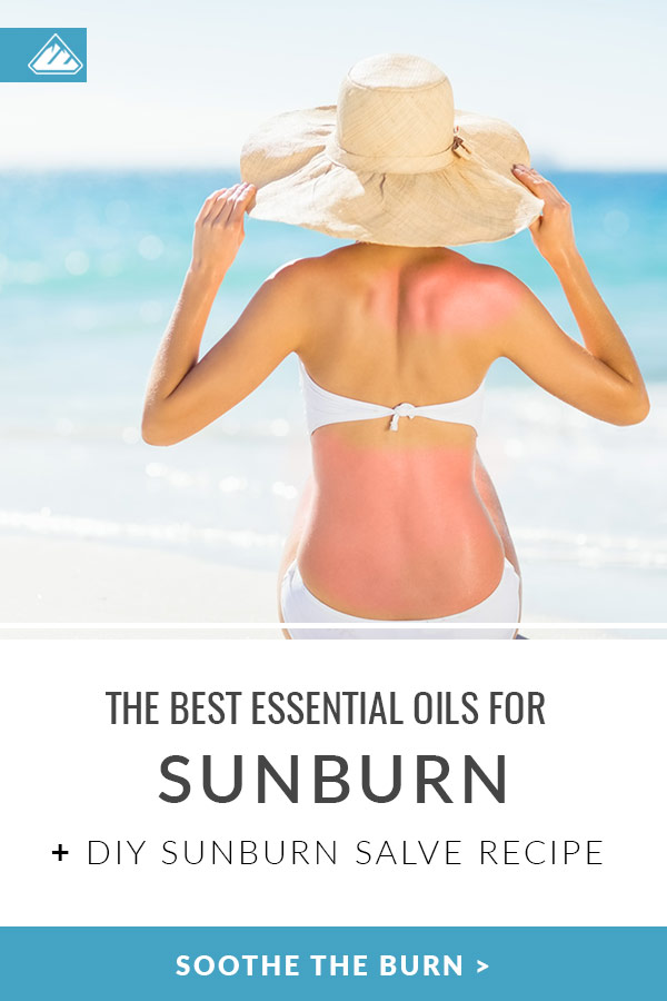 The Best Essential Oils for Sunburn