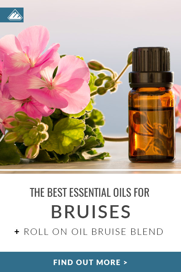 Essential Oil for Bruises