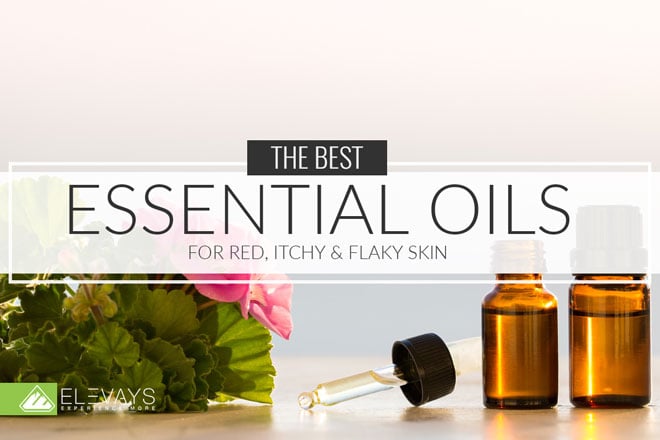 The Best Essential Oils for Red, Itchy, & Flaky Skin