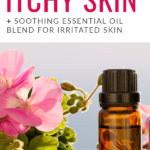The Best Essential Oils for Red, Itchy & Flaky Skin Pinterest Pin