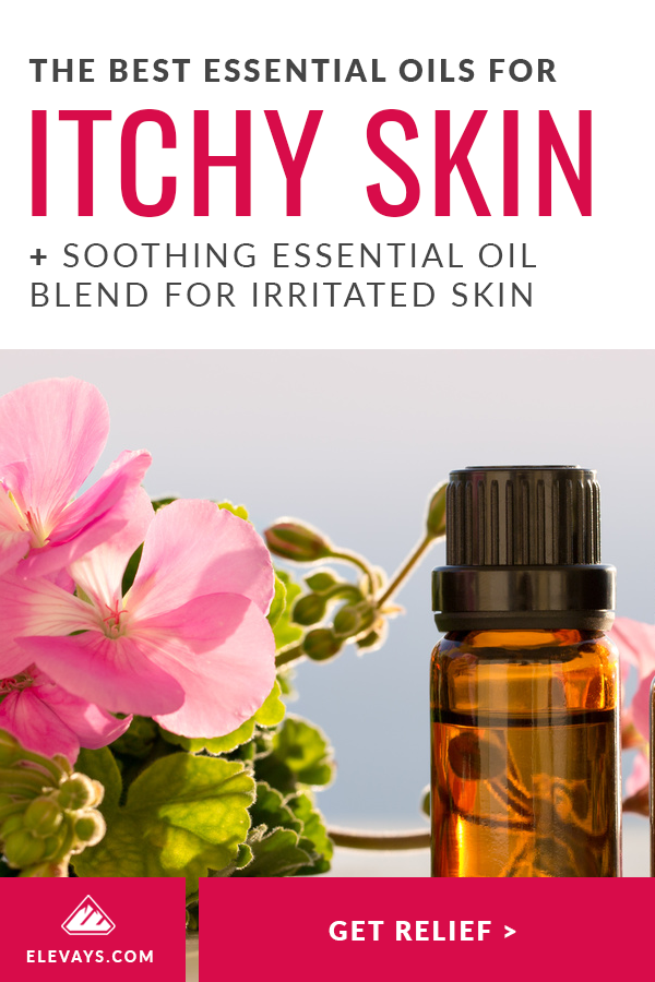 The Best Essential Oils for Red, Itchy & Flaky Skin Pinterest Pin