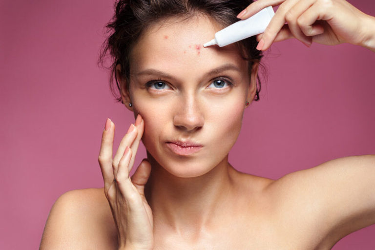 Maskne Victim? Here’s How to Deal with Acne Breakouts Naturally